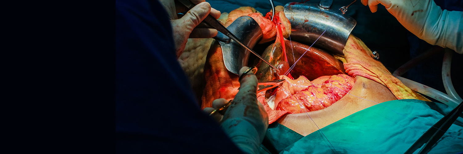 Patient's open abdomen with two surgeons performing procedure