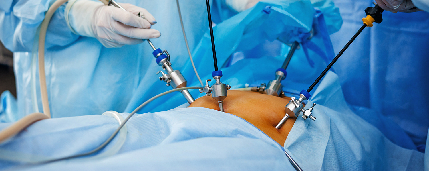 Gloved surgeons carry out laparoscopic surgey on patient