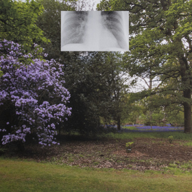 Photograph of English garden with small rectangular lung X-Ray image superimposed in the middle of the top half.