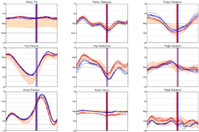 Nine line graphs showing data for pelvic tilt, obliquity and rotation, hip flexicon and adduction, thigh rotation, knee flexion, knee vanus and tibial rotation.