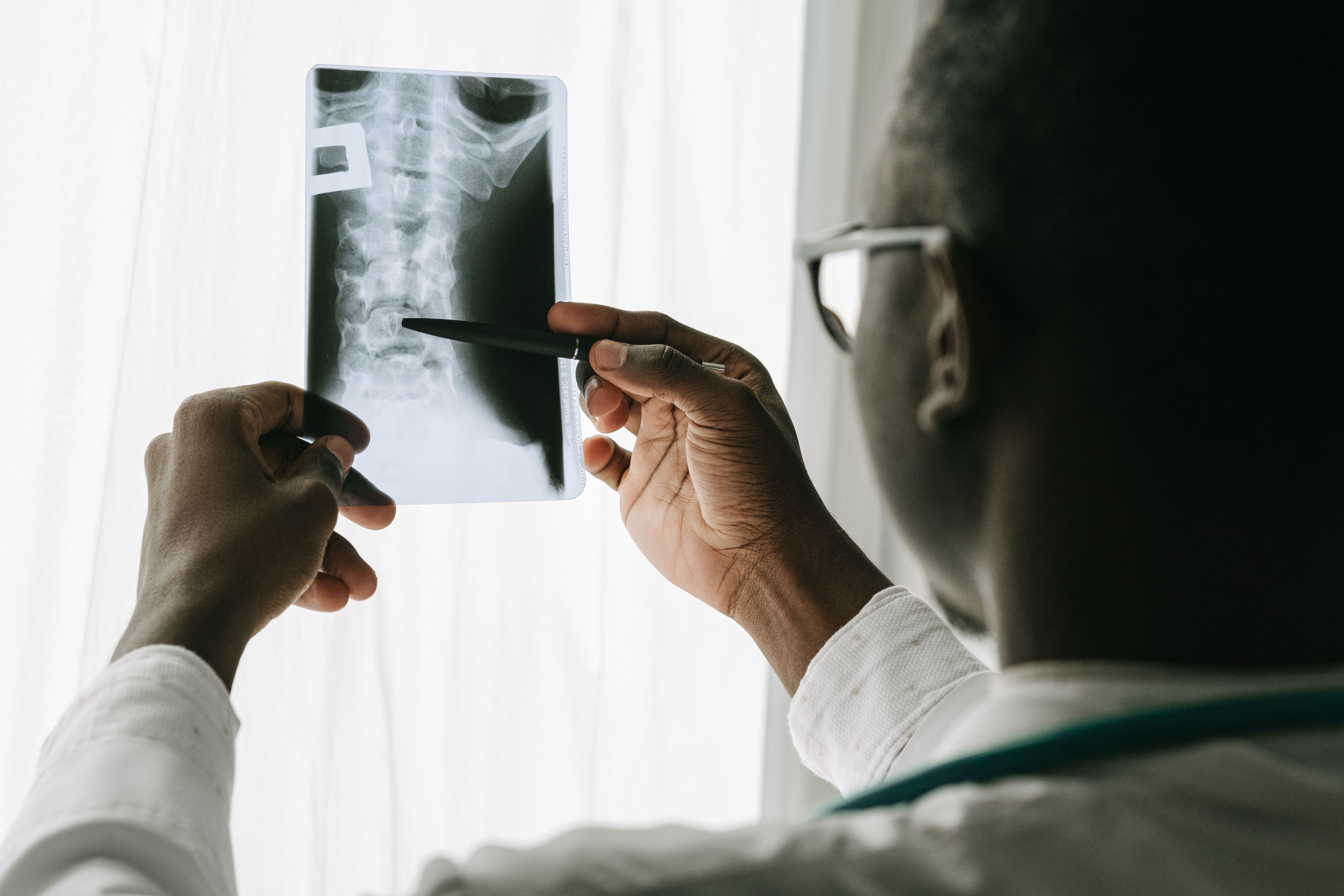 medical professional checks an X-ray of a spine