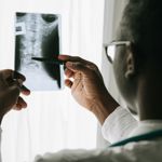 medical professional checks an X-ray of a spine