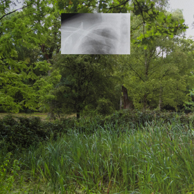 Photograph of English garden with small rectangular lung X-Ray image superimposed in the middle of the top half.