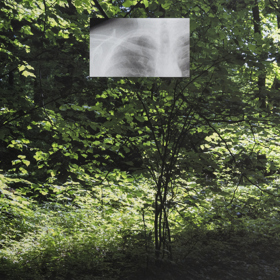 Photograph of English garden with small rectangular lung X-Ray image superimposed in the middle of the top half.