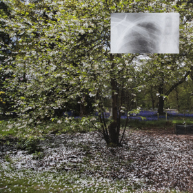 Photograph of English garden with small rectangular lung X-Ray image superimposed in the middle of the top half.