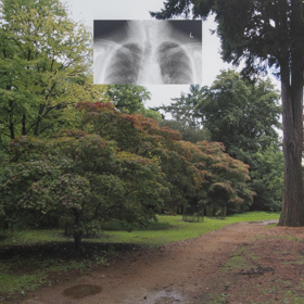 Photograph of English garden with small rectangular lung X-Ray image superimposed in the middle of the top half.