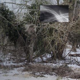 Photograph of English garden with small rectangular lung X-Ray image superimposed in the middle of the top half.