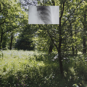 Photograph of English garden with small rectangular lung X-Ray image superimposed in the middle of the top half.