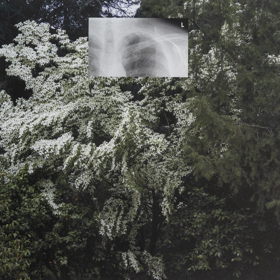 Photograph of English garden with small rectangular lung X-Ray image superimposed in the middle of the top half.