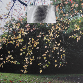 Photograph of English garden with small rectangular lung X-Ray image superimposed in the middle of the top half.