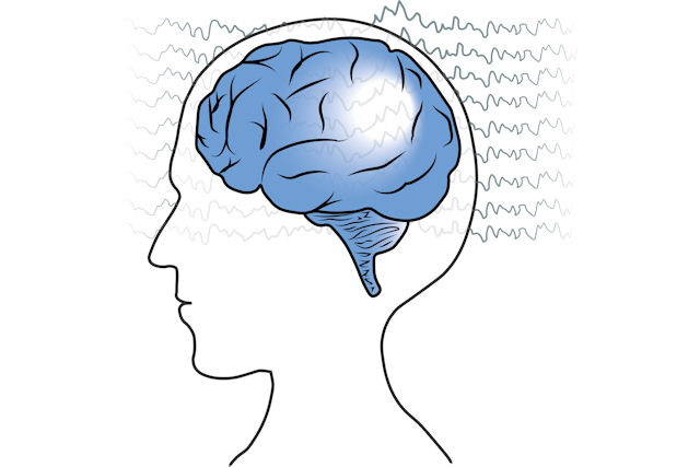 Electroencephalography (EEG)